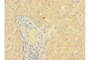 IHC analysis of paraffin-embedded human liver tissue, using MR1 antibody (1/100 dilution).