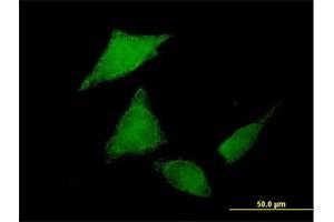 Immunofluorescence of purified MaxPab antibody to C9orf96 on HeLa cell. (C9orf96 anticorps  (AA 1-680))