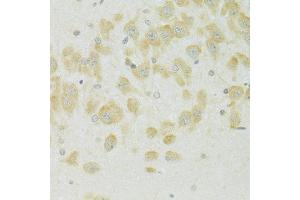 Immunohistochemistry of paraffin-embedded rat brain using SLC37 antibody (ABIN7270453) at dilution of 1:100 (40x lens).