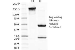 SDS-PAGE Analysis Purified MITF Mouse Monoclonal Antibody (D5). (MITF anticorps)
