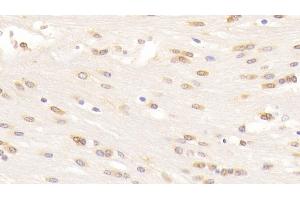 Detection of WNT5A in Mouse Cerebrum Tissue using Monoclonal Antibody to Wingless Type MMTV Integration Site Family, Member 5A (WNT5A)