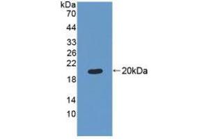 Figure. (MRPL1 anticorps  (AA 147-285))