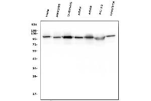 Western blot analysis of Hexokinase 1/HK1 using anti-Hexokinase 1/HK1 antibody (ABIN7600259).