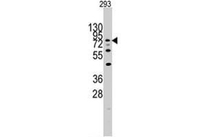 Western blot analysis of DYRK1A polyclonal antibody  in 293 cell line lysates (35 ug/lane). (DYRK1A anticorps  (N-Term))