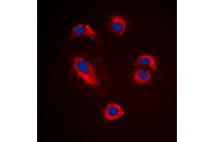Immunofluorescent analysis of MMP10 staining in Jurkat cells.