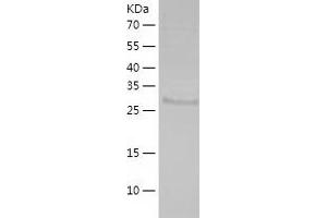 Western Blotting (WB) image for Sulfotransferase Family 1E Member 1 (SULT1E1) (AA 1-294) protein (His tag) (ABIN7125230) (SULT1E1 Protein (AA 1-294) (His tag))