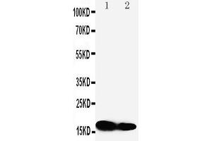 Anti-IFITM1 antibody, Western blotting Lane 1: SW620 Cell Lysate Lane 2: CEM Cell Lysate (IFITM1 anticorps  (N-Term))