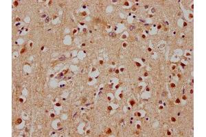 IHC image of ABIN7140181 diluted at 1:100 and staining in paraffin-embedded human brain tissue performed on a Leica BondTM system. (SOX1 anticorps  (AA 49-68))