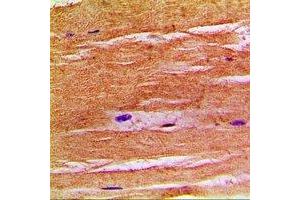 Immunohistochemical analysis of NHE8 staining in human skeletal muscle formalin fixed paraffin embedded tissue section. (NHE8 anticorps  (C-Term))
