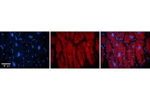 Rabbit Anti-KIF23 Antibody    Formalin Fixed Paraffin Embedded Tissue: Human Adult heart  Observed Staining: Cytoplasmic (cytoskeleton) Primary Antibody Concentration: 1:600 Secondary Antibody: Donkey anti-Rabbit-Cy2/3 Secondary Antibody Concentration: 1:200 Magnification: 20X Exposure Time: 0.