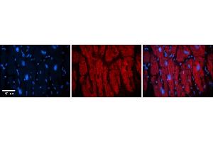 Rabbit Anti-KIF23 Antibody    Formalin Fixed Paraffin Embedded Tissue: Human Adult heart  Observed Staining: Cytoplasmic (cytoskeleton) Primary Antibody Concentration: 1:600 Secondary Antibody: Donkey anti-Rabbit-Cy2/3 Secondary Antibody Concentration: 1:200 Magnification: 20X Exposure Time: 0. (KIF23 anticorps  (Middle Region))