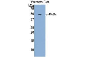 Western blot analysis of the recombinant protein. (ACVR1 anticorps  (AA 208-340))
