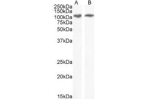 ABIN308413 (0. (ERN1 anticorps  (Internal Region))