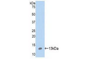 Detection of Recombinant S100A10, Human using Polyclonal Antibody to S100 Calcium Binding Protein A10 (S100A10) (S100A10 anticorps  (AA 1-96))