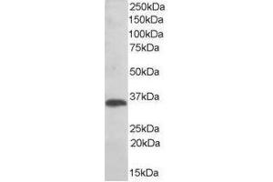 Image no. 1 for anti-Thioredoxin-Related Transmembrane Protein 1 (TMX1) (C-Term) antibody (ABIN374090) (TMX1 anticorps  (C-Term))