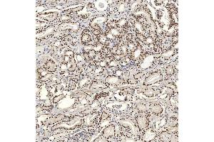 IHC analysis of U1A/SNRPA using anti-U1A/SNRPA antibody (ABIN7600891). (SNRPA1 anticorps  (AA 25-218))