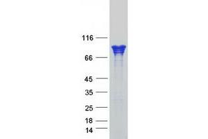 Validation with Western Blot