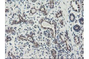 Immunohistochemical staining of paraffin-embedded Human breast tissue using anti-DPH2 mouse monoclonal antibody. (DPH2 anticorps)