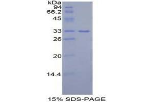 SDS-PAGE analysis of Mouse IGF2BP2 Protein. (IGF2BP2 Protéine)