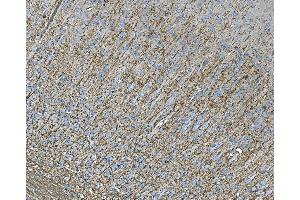 IHC analysis of RAB13 using anti-RAB13 antibody (ABIN7600599). (RAB13 anticorps  (AA 21-200))