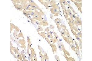 Immunohistochemistry of paraffin-embedded Mouse heart using CCT3 Polyclonal Antibody at dilution of 1:100 (40x lens). (CCT3 anticorps)
