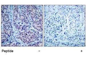 Image no. 1 for anti-Histone Deacetylase 2 (HDAC2) (AA 392-396) antibody (ABIN197337) (HDAC2 anticorps  (AA 392-396))