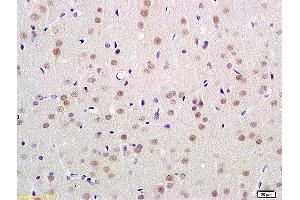 Formalin-fixed and paraffin embedded rat brain labeled with Anti-UBL7 Polyclonal Antibody, Unconjugated  at 1:100 followed by conjugation to the secondary antibody and DAB staining (UBL7 anticorps  (AA 51-150))