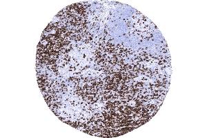 Tonsil Strong CD7 positivity of T lymphocytes mainly in the interfollicular area (Recombinant CD7 anticorps)