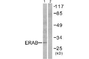 Western blot analysis of extracts from LOVO cells, using ERAB antibody. (HSD17B10 anticorps)