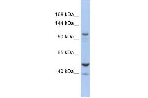 WB Suggested Anti-DDX58 Antibody Titration:  0. (DDX58 anticorps  (Middle Region))