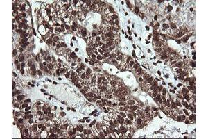 Image no. 5 for anti-Dynamin 1-Like (DNM1L) antibody (ABIN1497871)