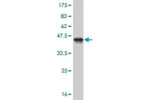 Western Blot detection against Immunogen (41. (MED21 anticorps  (AA 1-144))