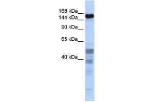 WB Suggested Anti-ZNF335 Antibody Titration:  0. (ZNF335 anticorps  (Middle Region))