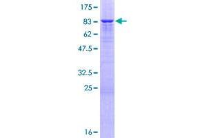Image no. 1 for Low Density Lipoprotein Receptor Related Protein 11 (LRP11) (AA 1-500) protein (GST tag) (ABIN1309731)
