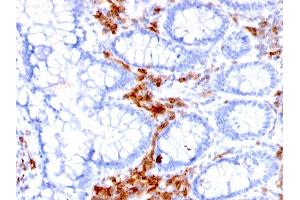 Formalin-fixed, paraffin-embedded human Colon stained with CD27 Mouse Monoclonal Antibody (LPFS2/1611).