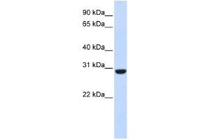 WB Suggested Anti-RCAN1 Antibody Titration:  0. (RCAN1 anticorps  (Middle Region))
