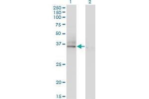Western Blot analysis of ASGR2 expression in transfected 293T cell line by ASGR2 monoclonal antibody (M05), clone 1D7.