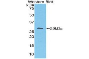 Detection of Recombinant FcgRI, Mouse using Polyclonal Antibody to Cluster Of Differentiation 64 (CD64) (FCGR1A anticorps  (AA 73-294))