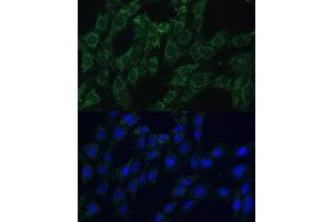 Immunofluorescence analysis of C6 cells using  Polyclonal Antibody (ABIN7265509) at dilution of 1:100 (40x lens).