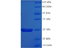 SDS-PAGE (SDS) image for Apolipoprotein C-II (APOC2) (AA 23-101) protein (His-SUMO Tag) (ABIN5709063)