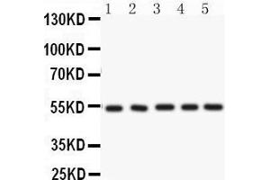 Anti-ARSA Picoband antibody, Western blotting All lanes: Anti ARSA  at 0. (Arylsulfatase A anticorps  (C-Term))