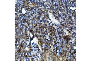 IHC analysis of GPCR RDC1/CXCR-7/ACKR3 using anti-GPCR RDC1/CXCR-7/ACKR3 antibody (ABIN7602889). (CXCR7 anticorps  (C-Term))