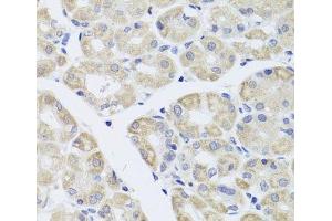 Immunohistochemistry of paraffin-embedded Human stomach using DISC1 Polyclonal Antibody at dilution of 1:100 (40x lens).