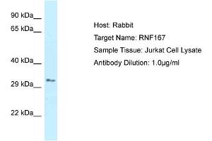 Host: Rabbit Target Name: RNF167 Sample Type: Jurkat Whole Cell lysates Antibody Dilution: 1. (RNF167 anticorps  (C-Term))