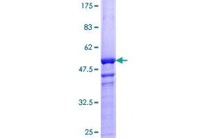 Image no. 1 for Vascular Endothelial Growth Factor B (VEGFB) (AA 1-207) protein (GST tag) (ABIN1324980)