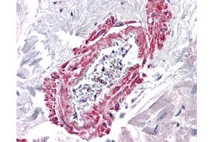 Anti-AGTR1 antibody IHC of human heart, vessel.