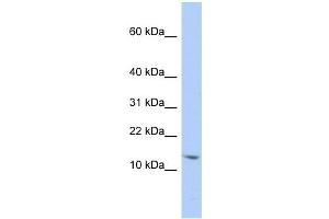 SNRPD2 antibody used at 1 ug/ml to detect target protein. (SNRPD2 anticorps  (N-Term))