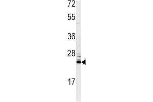 Western Blotting (WB) image for anti-Methionine Sulfoxide Reductase A (MSRA) antibody (ABIN3003138) (MSRA anticorps)