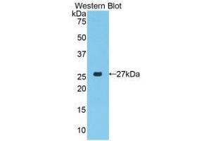 Western blot analysis of the recombinant protein. (PRTN3 anticorps  (AA 24-249))