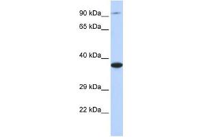 BBS5 antibody used at 1 ug/ml to detect target protein.